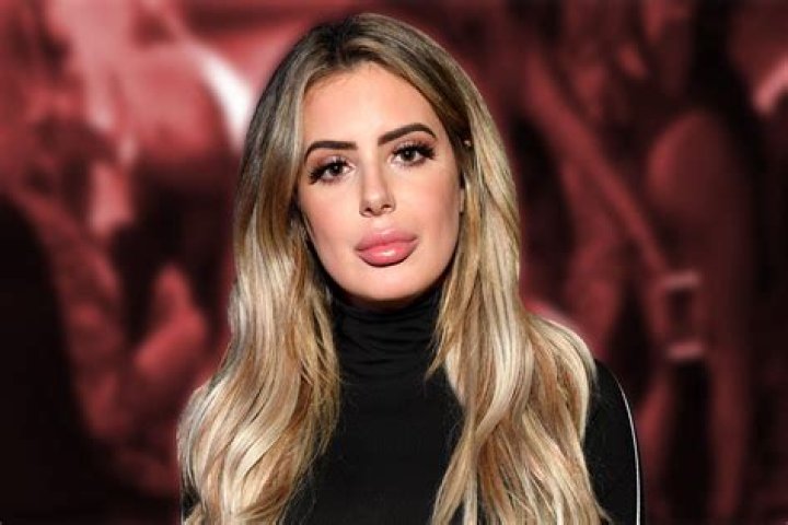 Brielle Biermann’s Huge Lips Slammed For Looking Like She Had ‘An Allergic Reaction’ After Posting New Pic!
