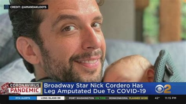 Broadway Star Nick Cordero Has Leg Amputated After COVID-19 Diagnosis
