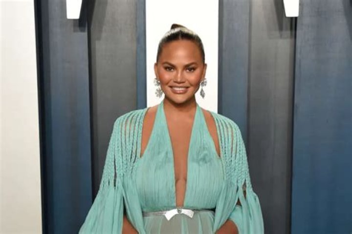 Chrissy Teigen Troll Disses Her For Having ‘Balding Hair’ In Runway Pic – Check Out Her Reaction!