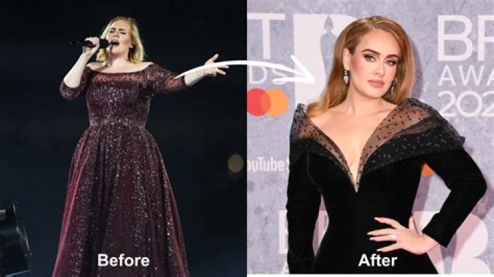 Did Adele Have Plastic Surgery In Addition To Her Weight Loss?