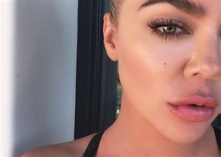 Khloe Kardashian Under Fire As Internet Accuses Reality Star Of More Lip Injections — Turns Off Comments