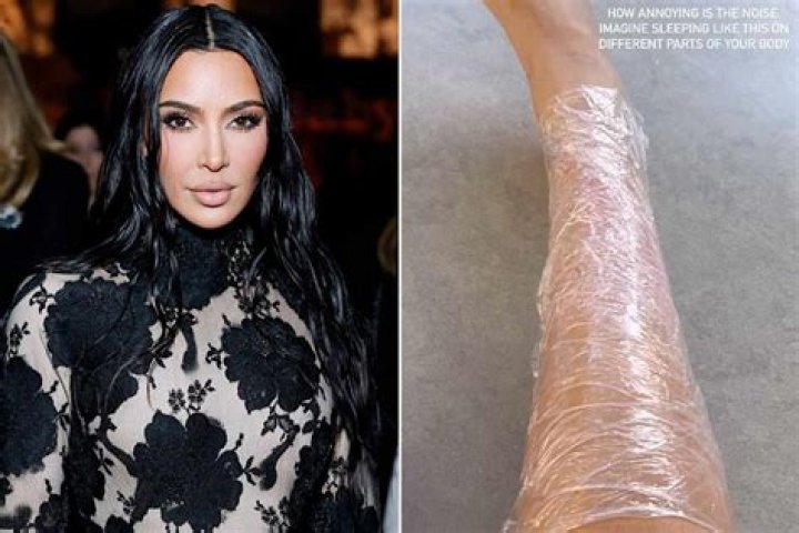 Kim Kardashian Got Psoriasis Flare From Her Met Gala Diet