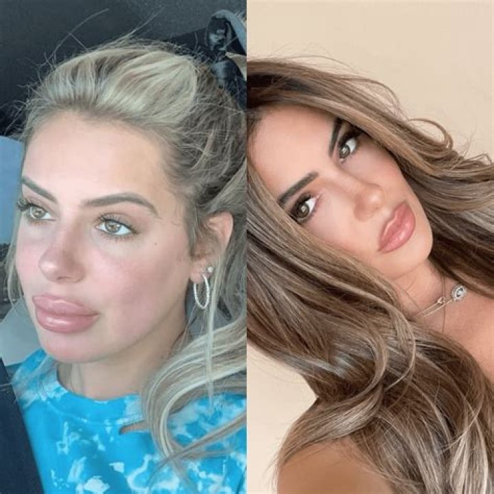 Kim Zolciak’s Daughter Brielle Biermann Talks Plastic Surgery – Admits She Plans To ‘Redo My Whole Body!’