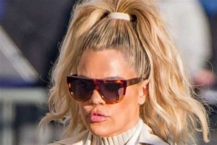 KUWK: Khloe Kardashian – Did She Get Lip Fillers Or Are They Actually Natural?