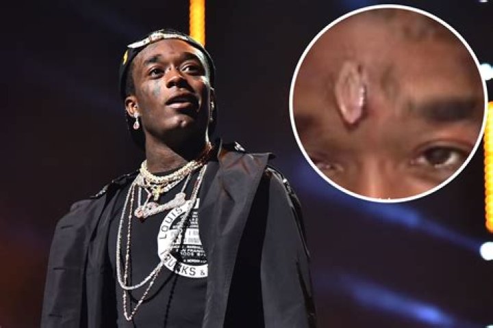Lil Uzi Vert Gets $24 Million Pink Diamond Imbedded In His Forehead – Videos!