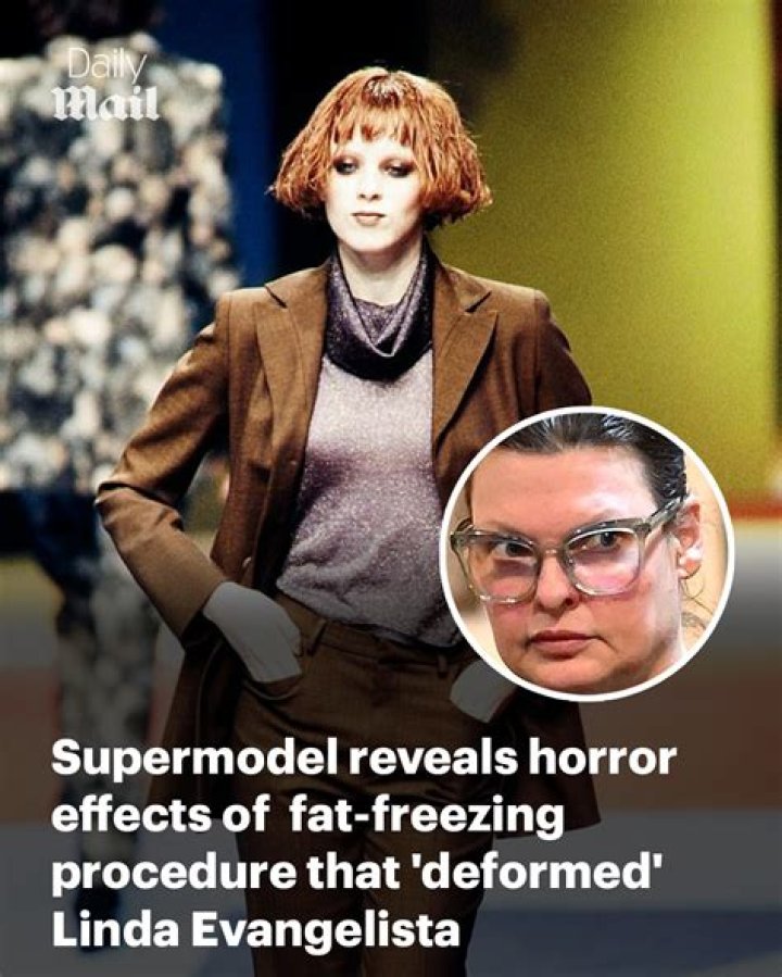 Linda Evangelista Made A Remark About The Procedure That Deformed Her