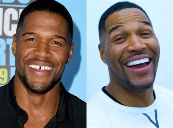 Michael Strahan Gets Rid Of His Iconic Tooth Gap – Check Out The Video!