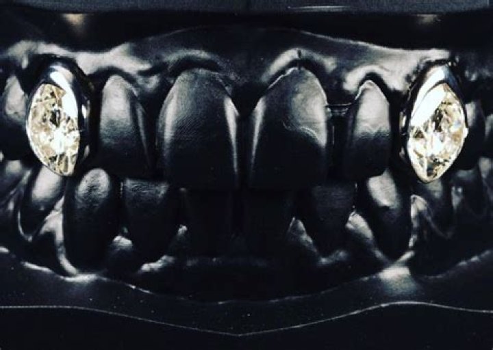 Post Malone Gets Diamond Fangs And Now He Literally Has A $1 Million Smile – Pic!