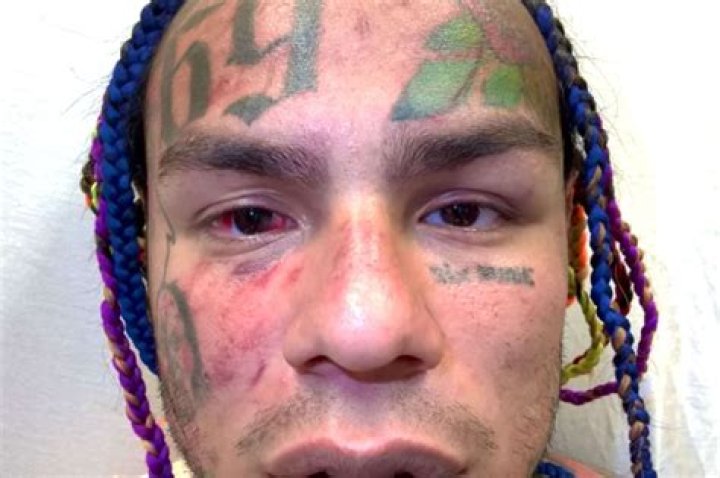 Tekashi 6ix9ine Hit With $150 Million Lawsuit Due To Revenge Shooting