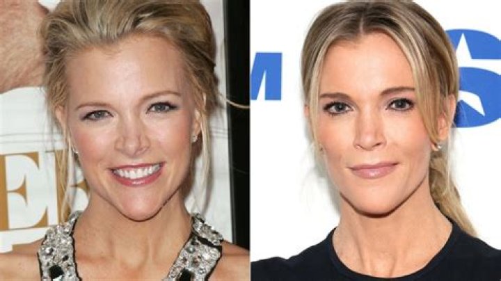 Tinsley Mortimer’s Latest Picture Goes South Quickly With Plastic Surgery Debate
